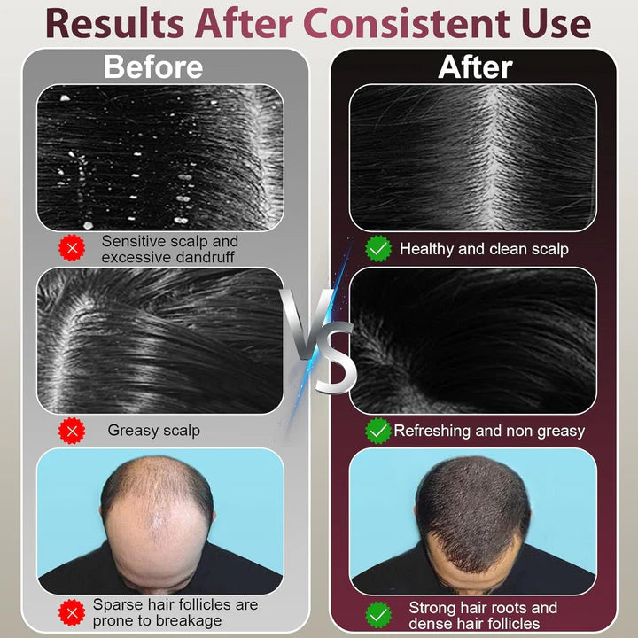 Laser Hair Growth Comb – Electric Scalp Massager & Oil Applicator