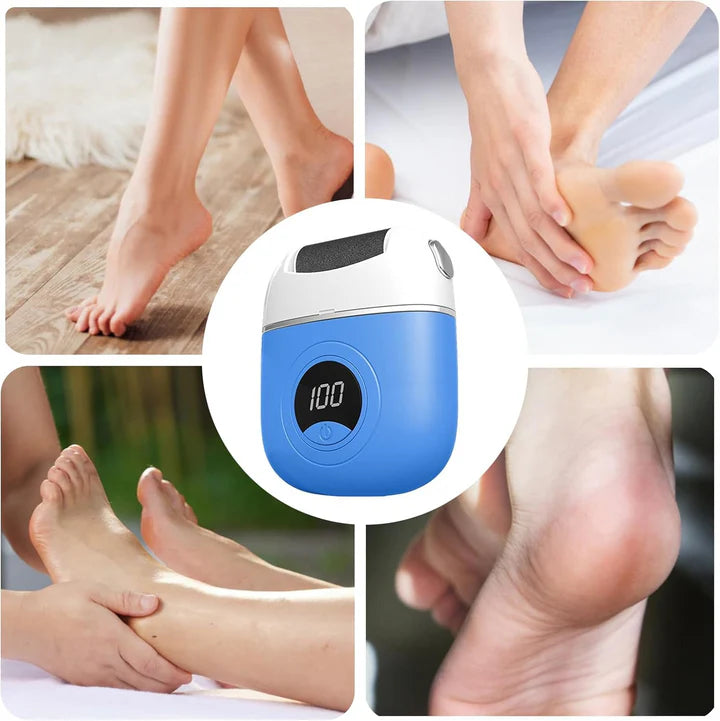 Portable Foot Polisher - Skin Exfoliator