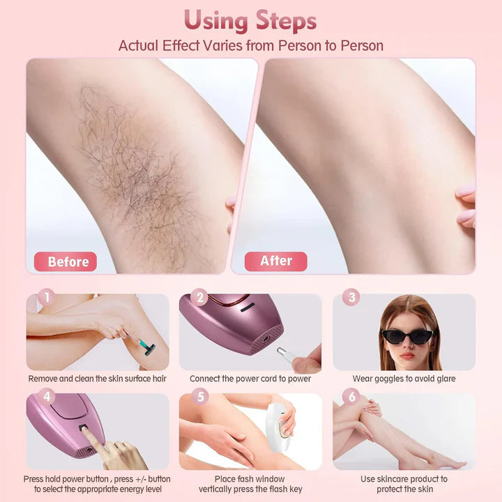 IPL Laser Hair Removal Device – Permanent Hair Remover
